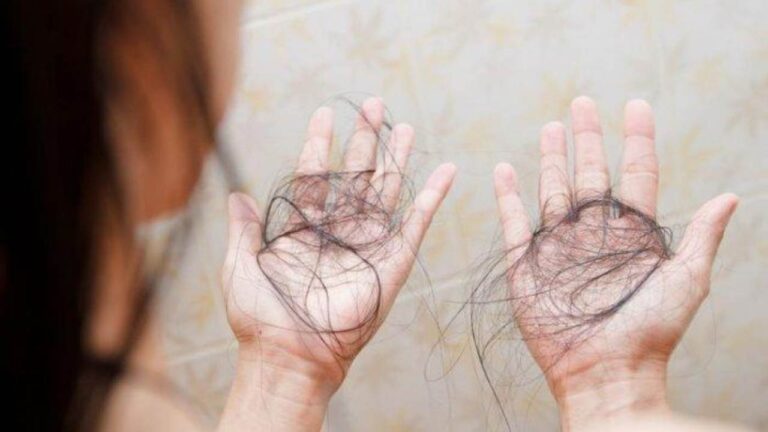 Rambut Rontok Jadi Isu Nasional: Usulan Asuransi Publik Korea Selatan Picu Perdebatan Hangat